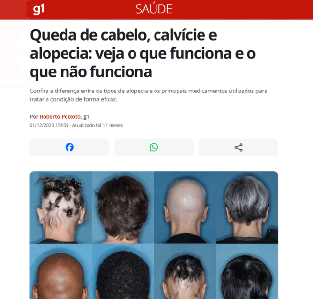 Acabe com a Queda de Cabelos — imagem 3